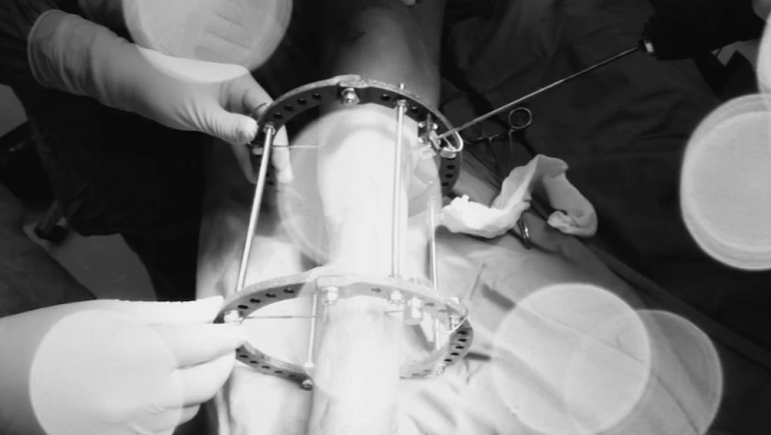 Bartın Sağlıkta Yeni Bir Adım Attı