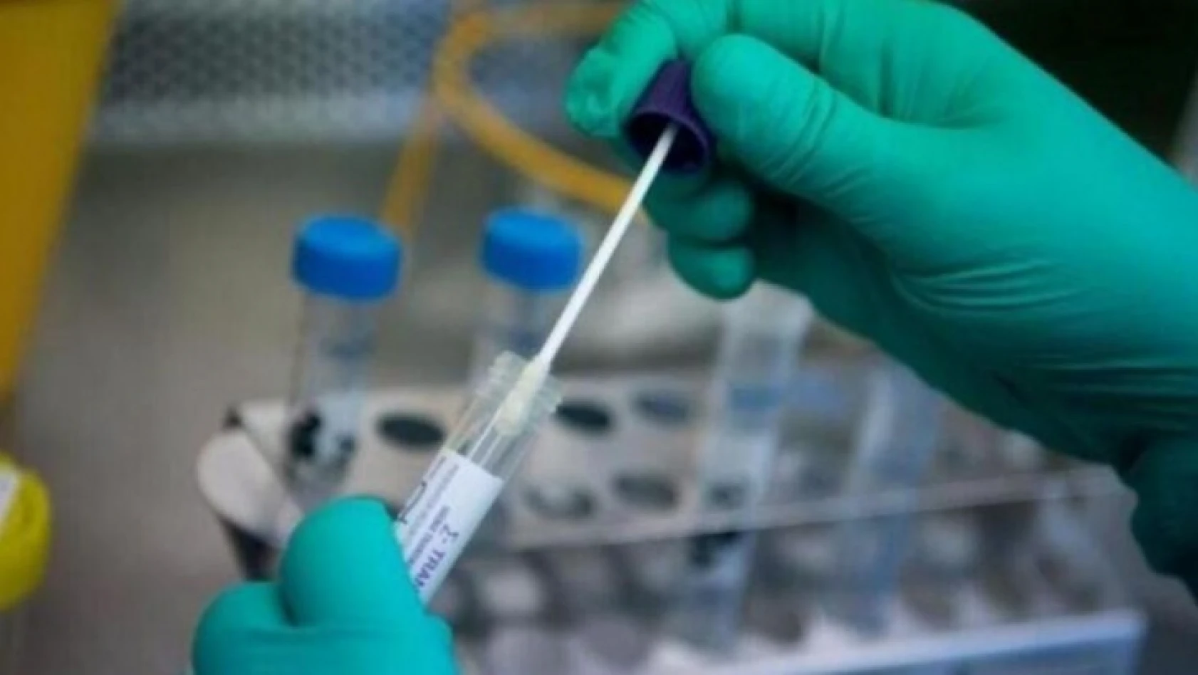 Kurtkaya 'PCR yerine hızlı test kiti uygulanmalı'