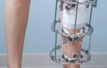 Bartın Sağlıkta Yeni Bir Adım Attı