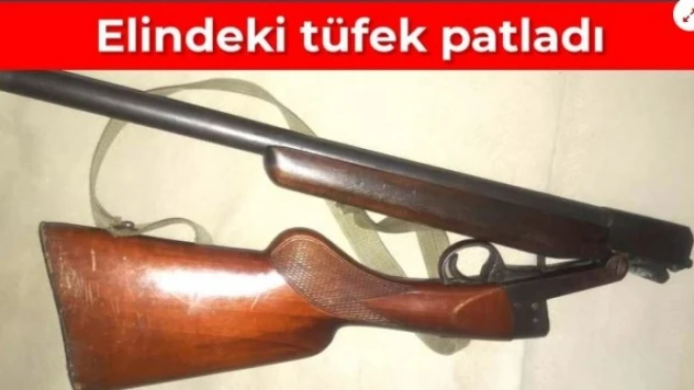 Temizlediği tüfek ateş aldı