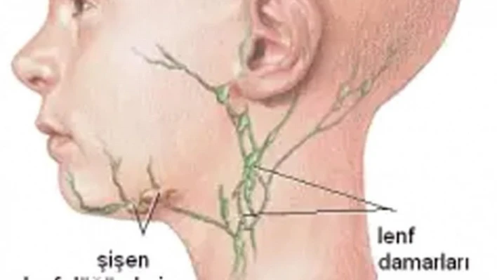 Koç'tan Lenfoma Hastalığı Uyarısı