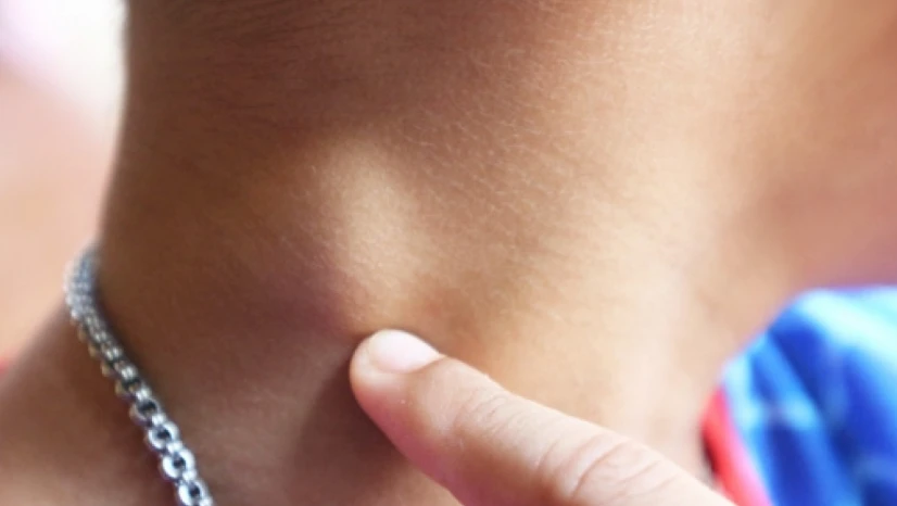 Bacak şişliği, gece terlemesi veya kilo kaybı varsa dikkat!